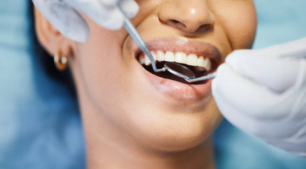 Best Emergency Tooth Extraction in Van Buren, MO