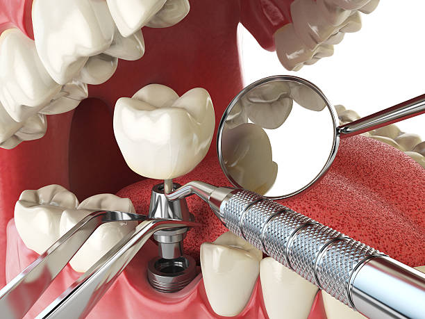 Best After-Hours Emergency Dentist in Van Buren, MO